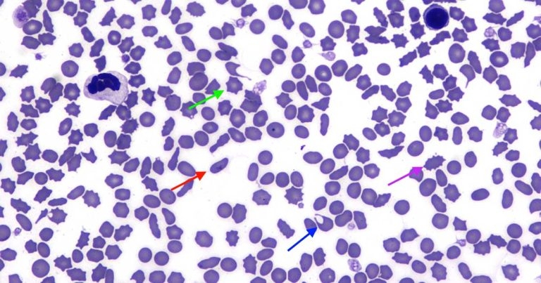 Red cell morphological alterations in a cat with anaemia