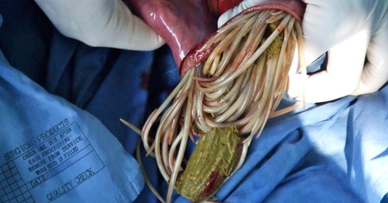 Parasitic disease as a cause of colic