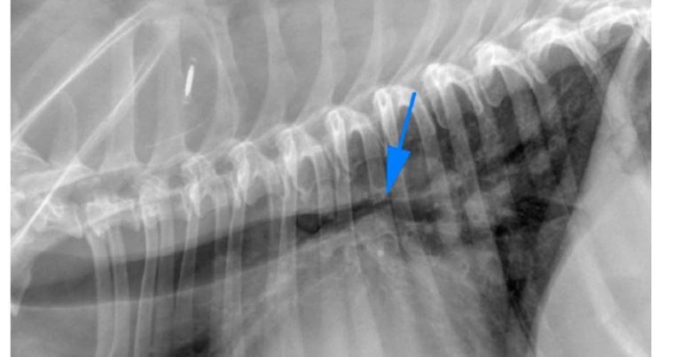 Lower respiratory tract disease