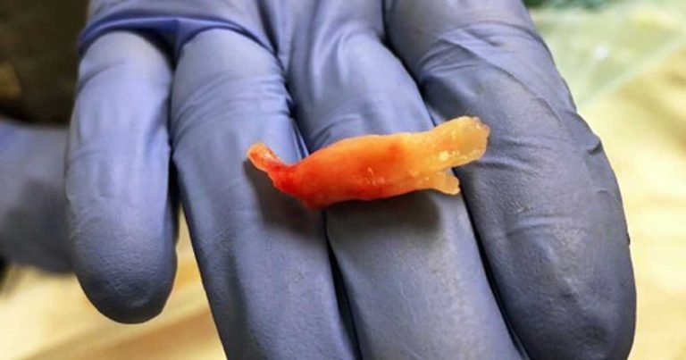 Post-intubation OFTP in brachy dog