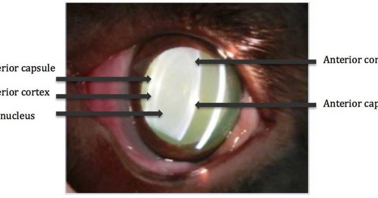 Canine cataracts: classification, aetiology and complications