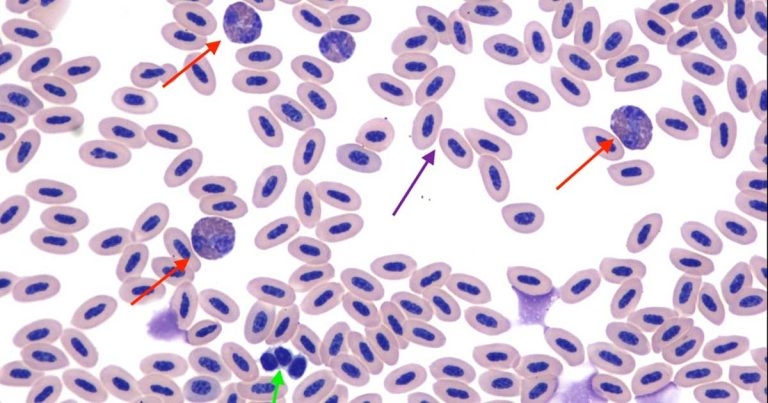 Case of a cockatoo with leukocytosis