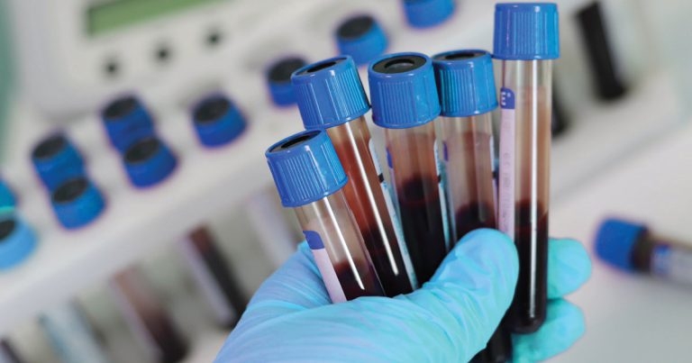 To test or not to test? That is the question