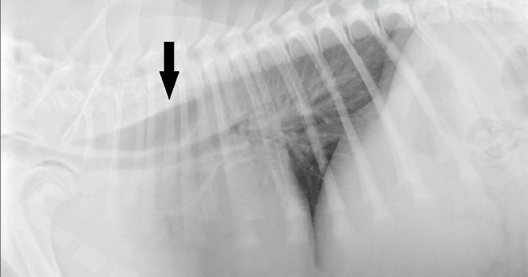 Persistent right aortic arch