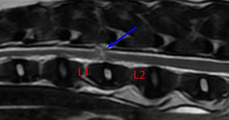 Acute non-progressive nucleus pulposus extrusion in a terrier