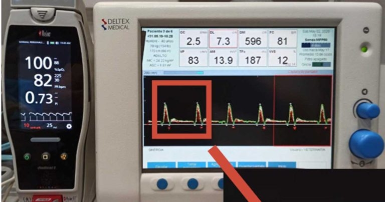 Atypical recording tools for monitoring anaesthesia