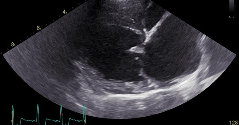 Canine mitral valve disease in a female cross-breed