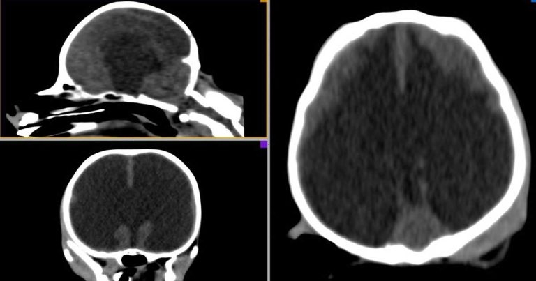 Canine congenital hydrocephalus