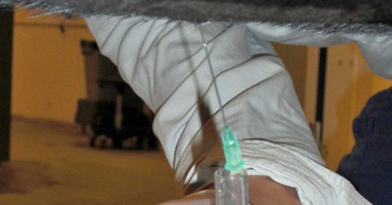 Abdominocentesis in horses