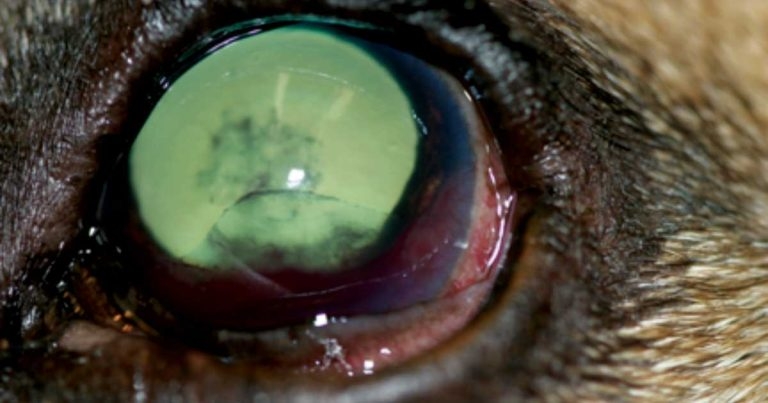 Glaucoma diagnosis and management