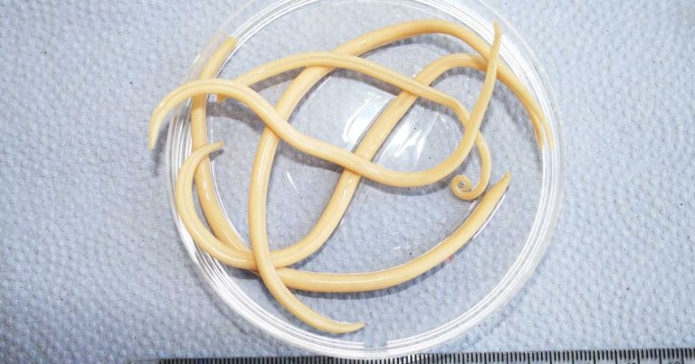 Equine parasitic disease: prevention, treatment and worming strategies