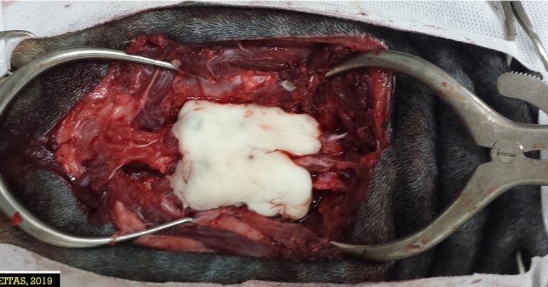 Spinal fracture/luxation approach