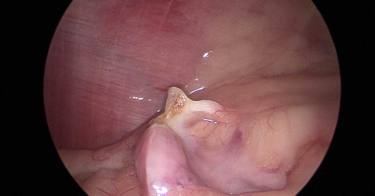 Ovariohysterectomy and ovariectomy in canine patients