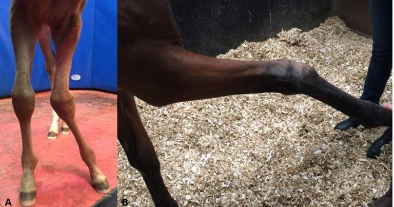 Musculoskeletal disorders: types, causes, diagnostics and treatment