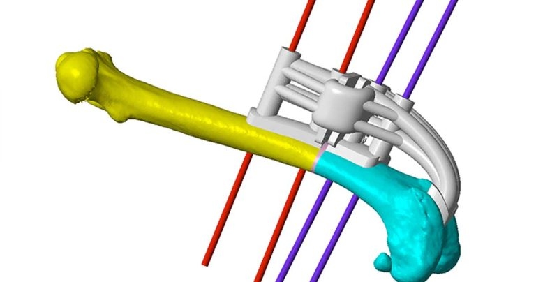 Distal femoral osteotomy and isometric suture stabilisation