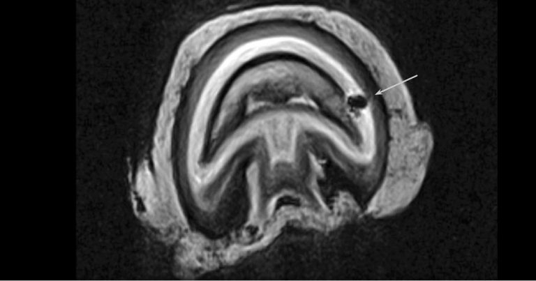 Equine pedal osteitis