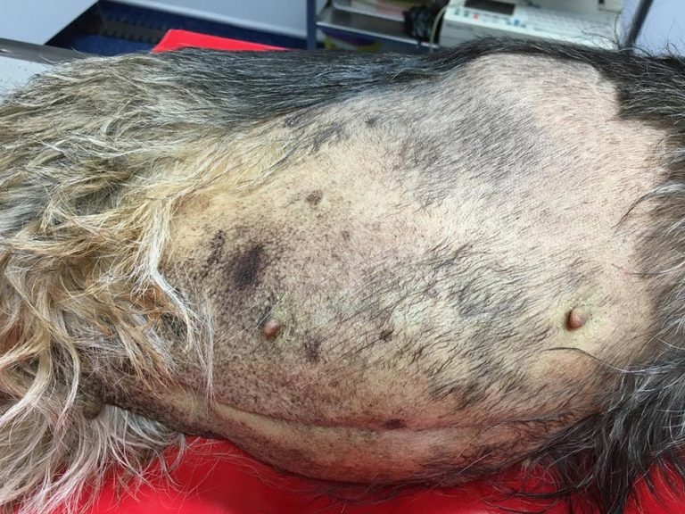 Acute pancreatitis – diagnosis, management and communication