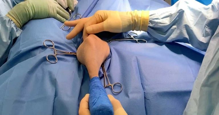 Latest in canine stifle conditions – diagnosis and treatment