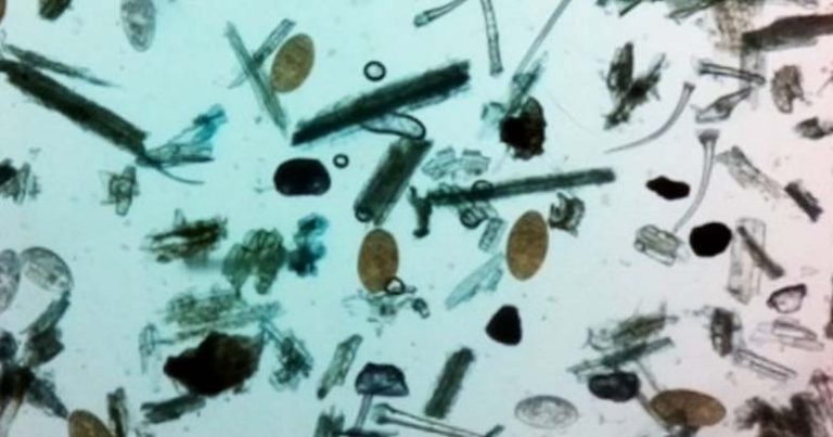 Finding eggs in bovine faeces – is it a fluke?