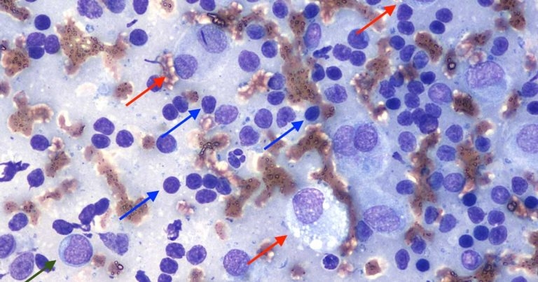 Cytology findings from a skin nodule in a young dog