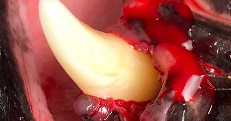 Dental health – periodontal disease treatment and prevention