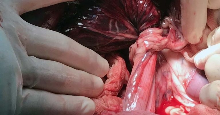 Ultrasonographic diagnosis of colonic volvulus in dogs