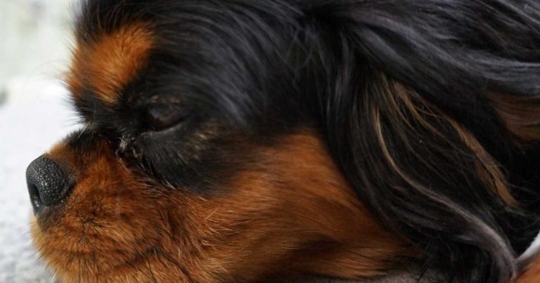 Cranioplasty for treating caudal occipital malformation syndrome