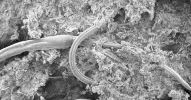 Sheep parasites of note, part 2 – nematodes