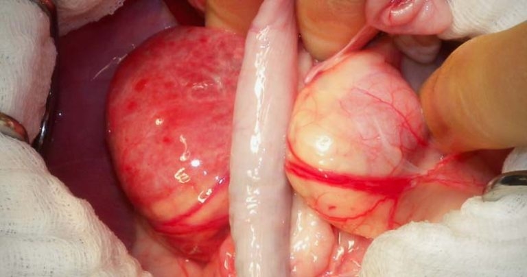 Urolithiasis diagnostics – clinical presentation and associated tests