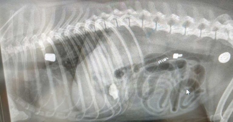 Resolution of an unusual oesophageal foreign body