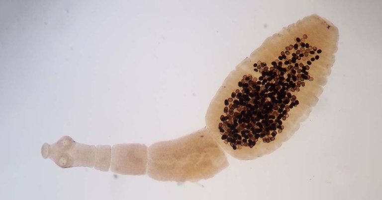 Sheep parasites of note part 4 – cestodes