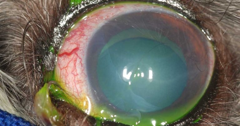 Ocular salvage procedure options – when is right time to enucleate?