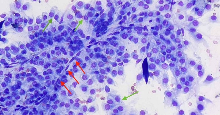 Cytology findings from a leg skin mass in a dog