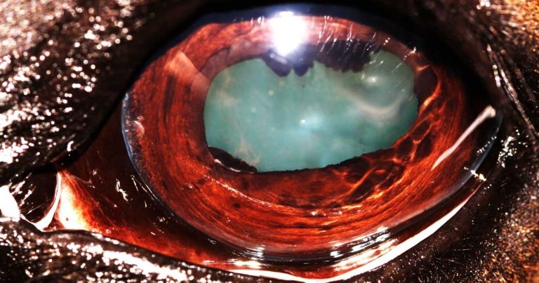 Eye-opening laser treatment on offer at Six Mile Bottom