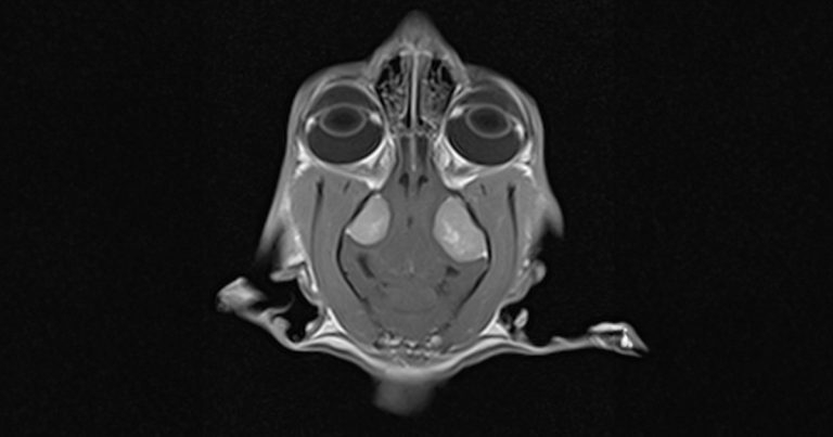 Cats: surgical management of intracranial meningiomas