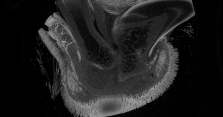 Digital pad corns in sighthounds – where are we now with treatment?