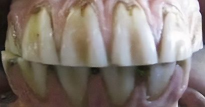 Dental disease – common problems and management