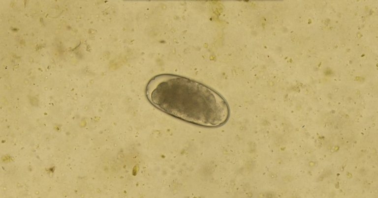 Equine faecal egg count capabilities added to Zoetis’ analysis tool