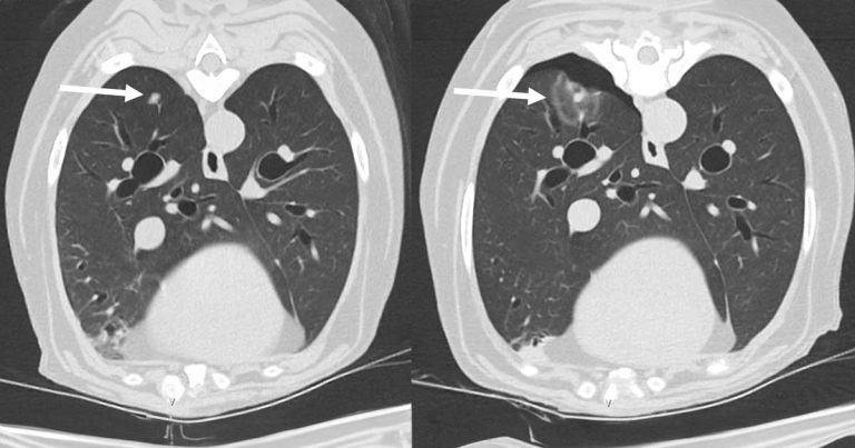 Vet and human hospitals collaborate for Belgian shepherd’s cancer treatment