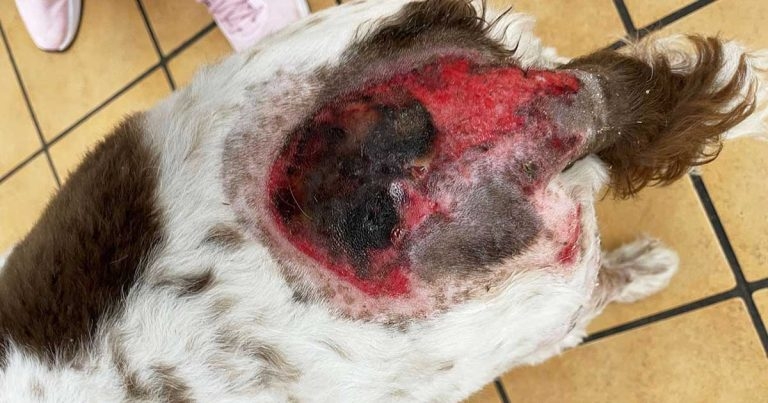 Burns: first aid, triage, wound care and secondary healing