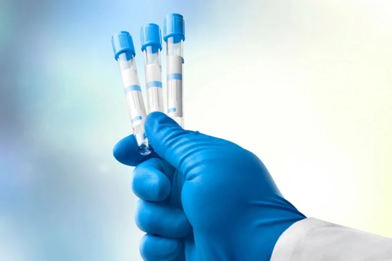 Action needed to stop next ‘pandemic’ – pharma boss