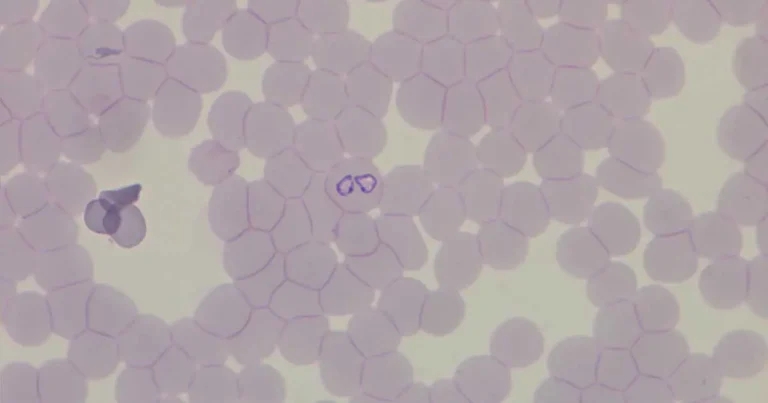 Disease, diagnostics and travel