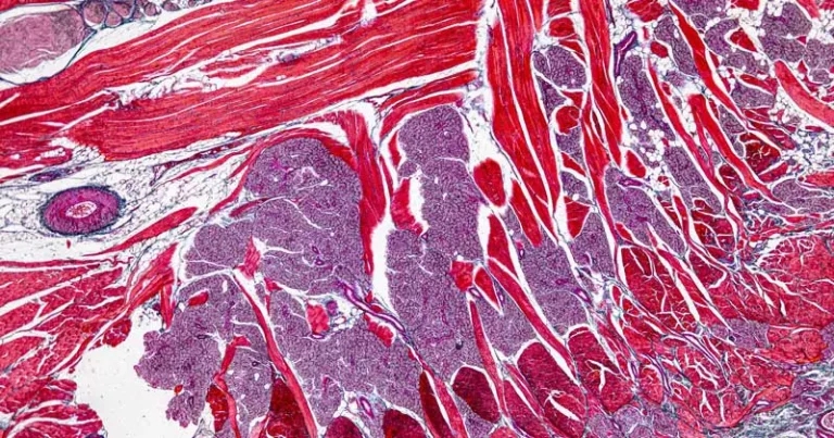 Fat-sensitive conditions in dogs