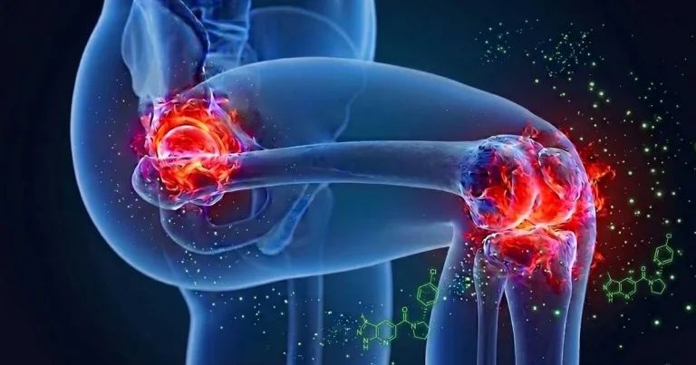 Researchers identify ‘hugely exciting’ OA treatment