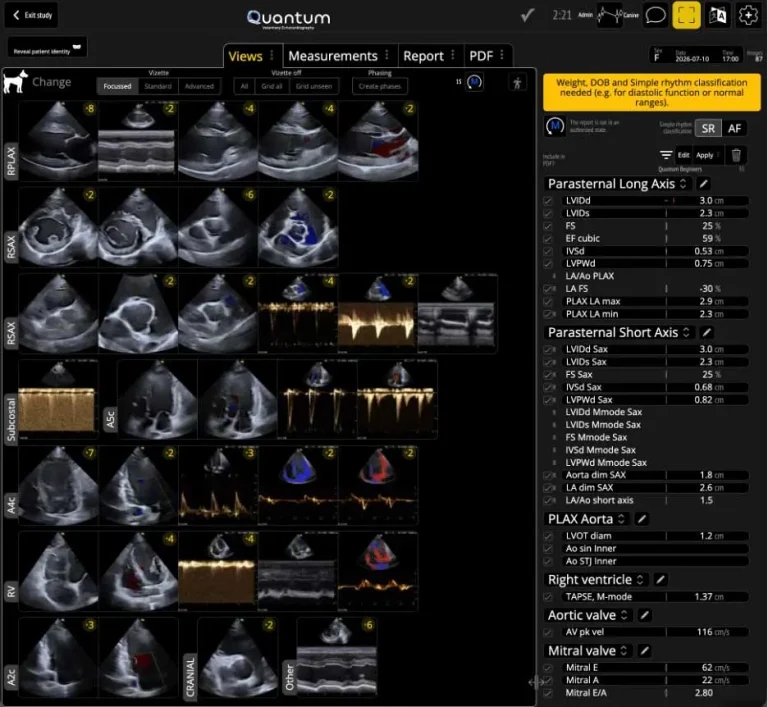 Quantum: bringing AI-powered echocardiography to every practice